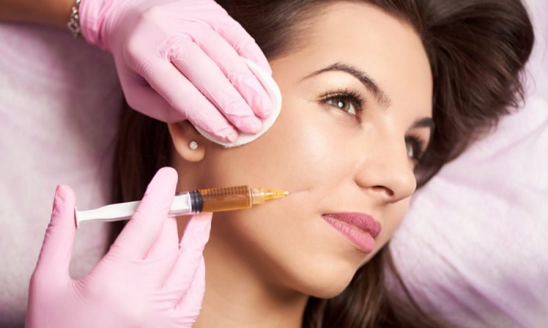 Dermal Fillers